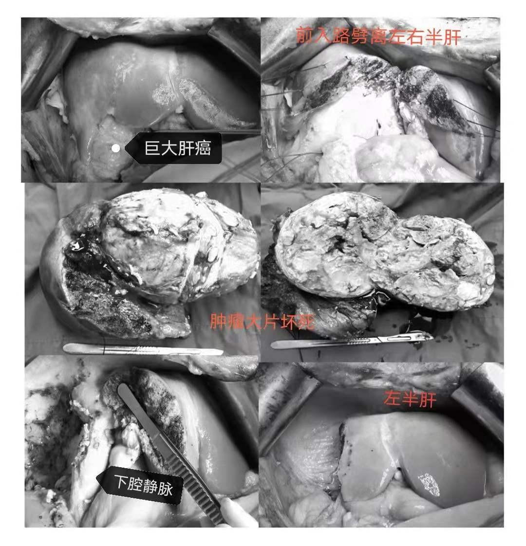 龙川县邓振中最新消息