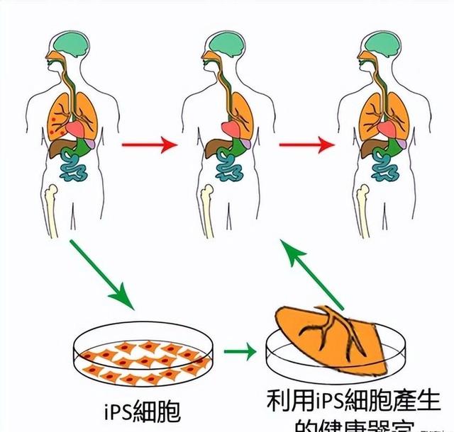 克隆肾脏2016最新消息