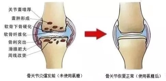 关节软骨再生最新消息